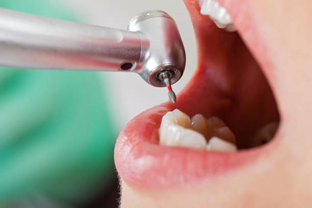 Best Weekend Emergency Dentist in Lake Hamilton, FL